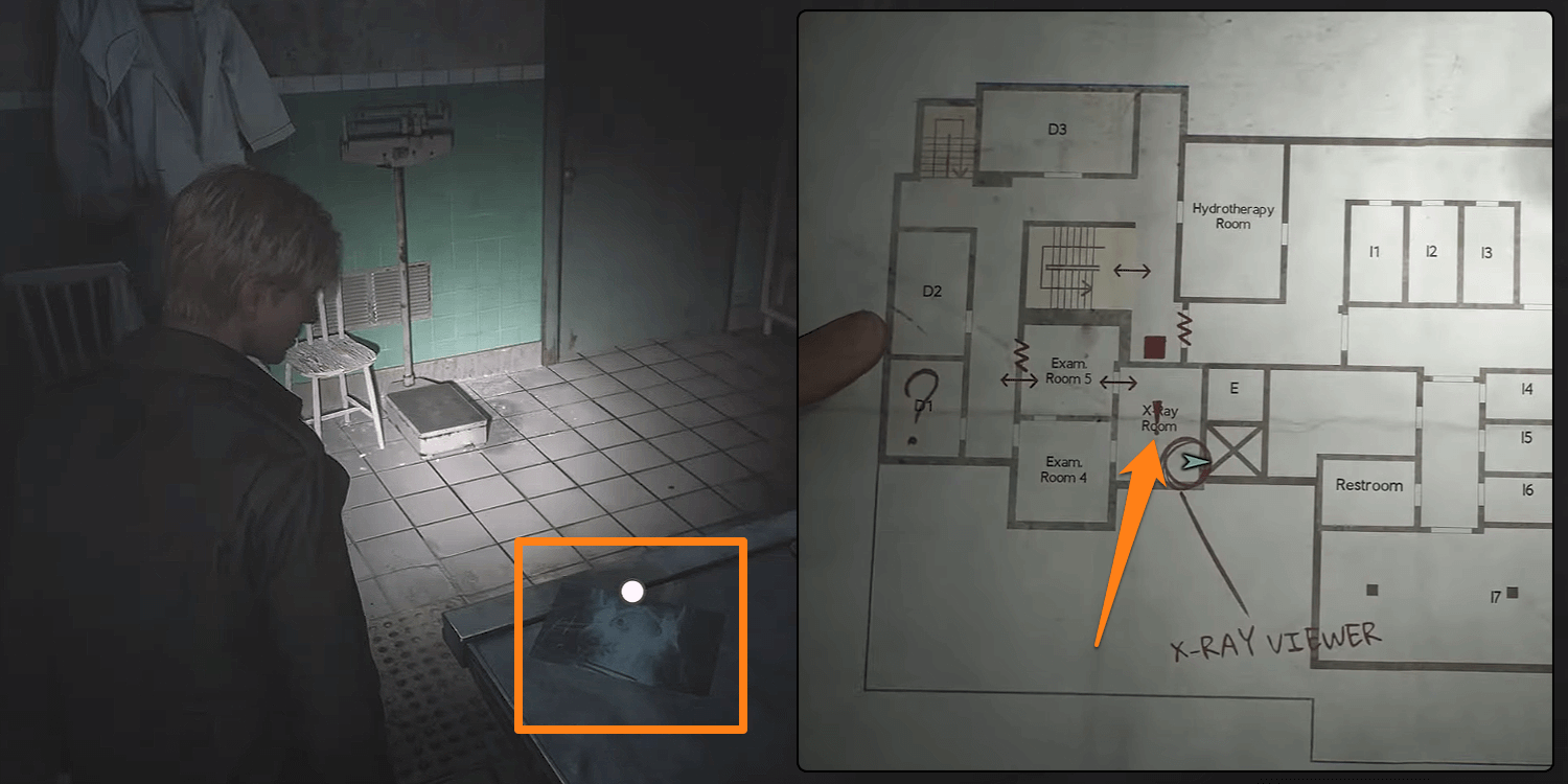 Silent Hill 2 Xray in Xray Room